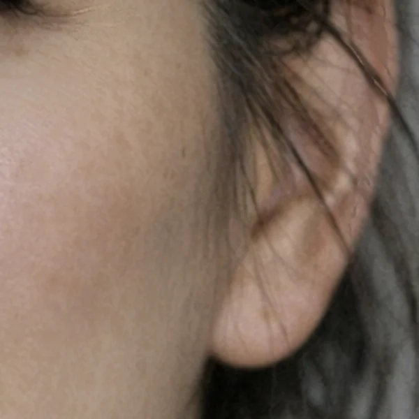 Same close-up after retouching. The spots are lighter and the pores are still there.